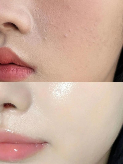 為什么皮膚還行，但是化妝就卡粉？