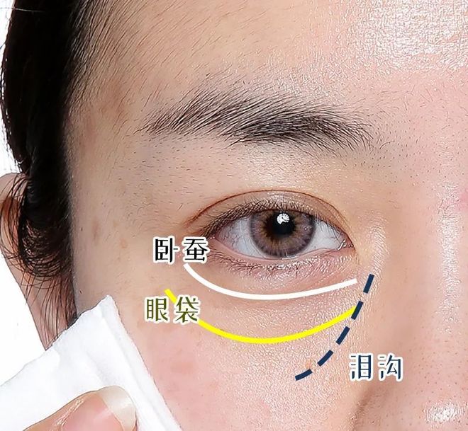 告別“熊貓眼”與歲月紋，重煥眼周光彩