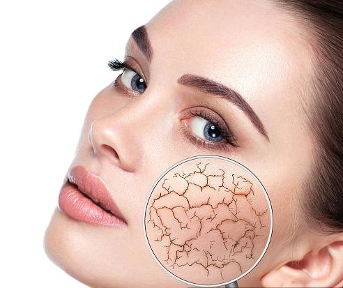 敏感肌換季自救，養(yǎng)出“耐打”好皮膚