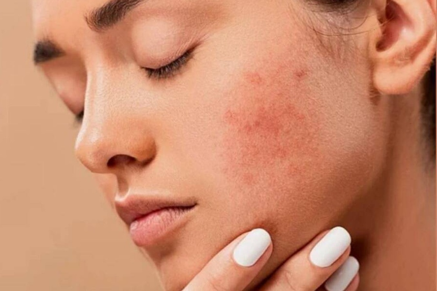 皮膚屏障受損的信號與科學修復指南