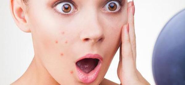 閉口痘痘反復(fù)不消？幫你徹底擺脫煩惱