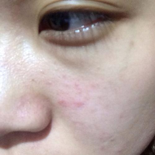 皮膚發出求救信號別忽視！