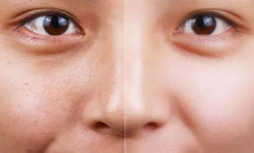 春天一曬就黑？踏青出游護膚指南